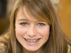 young girl in braces