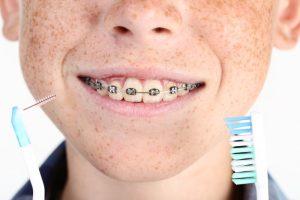 child with braces holding brush and flosser