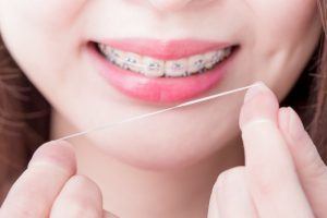 young girl flossing with braces 