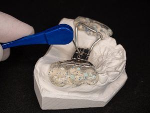 model teeth with a palatal expander