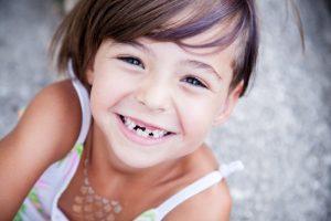 little girl with missing teeth 