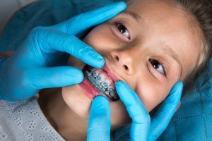 young girl with swollen gums getting braces examined