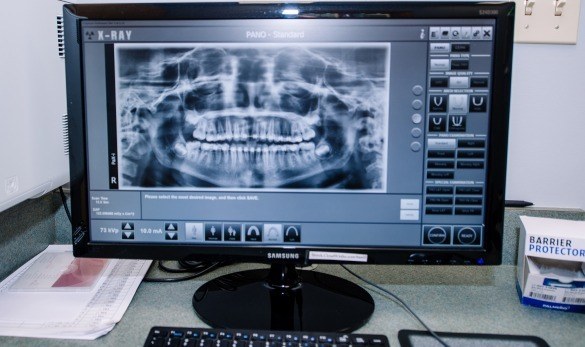 X-ray on screen