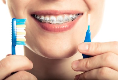 Caring for Your Braces