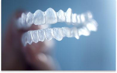 In-House Clear Aligners