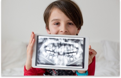 Two-Phase Orthodontic Treatment